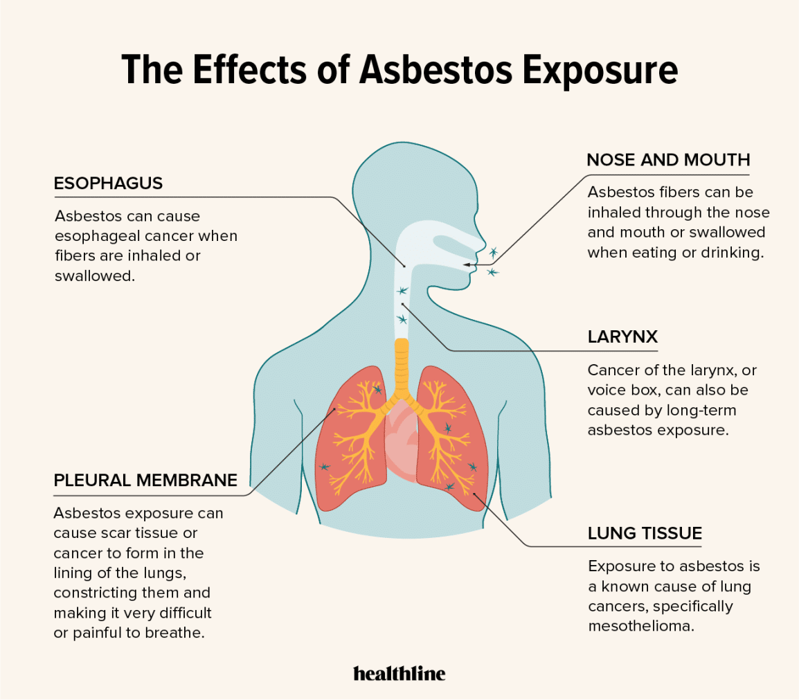 Asbestos lawsuit